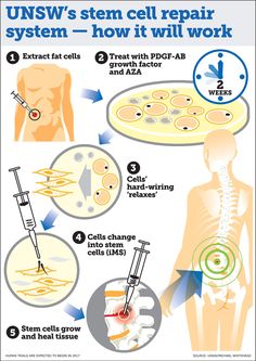 What Is Stem, Cord Blood Banking, Stem Cell Research, Human Bones, Animal Model, Stem Cell Therapy, Cell Therapy, Cell Biology