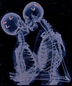 x - ray image of two skeletons with butterflies on their heads