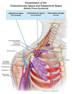 the posterior view of the shoulder and upper back pain, with labels on each side