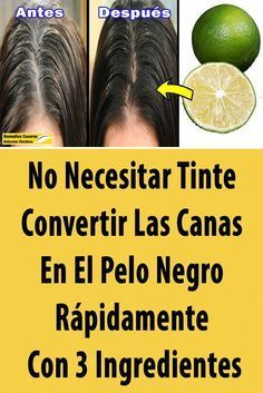 Grey Hair Remedies, Grey Hair Care, Natural Remedies For Migraines, Granny Hair, Low Estrogen, Dry Skin Remedies, Home Remedies For Hair, Permanent Hair Dye, Cold Home Remedies