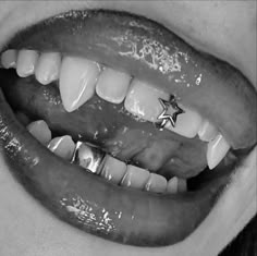 an open mouth with white teeth and silver stars on the upper part of the mouth