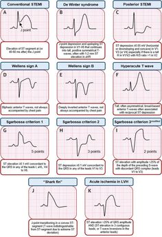 some diagrams showing the different types of waves