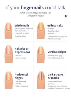 Nail Health Signs, Fingernail Health, Emerald Nails, Opal Nails, Health Signs, Nail Bed, Peinados Recogidos, Brittle Nails, Nail Growth