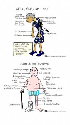 the anatomy of an older woman's body