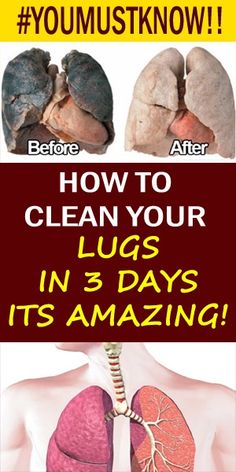 Smokers, Attention: You Can Remove All The Toxins From The Body In 3 Days: The Method That Removes Toxins From The Walls Of The Lungs, Natural Hemroid Remedies, Natural Add Remedies, Natural Remedies For Migraines, Health Articles Wellness, Health And Wellness Quotes, Natural Health Care, Glow Skin, Remove Toxins