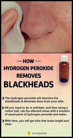 Curly Man, For Blackheads, Black Heads, Get Rid Of Blackheads, Cystic Acne, Image Skincare, Hydrogen Peroxide, Looks Black, Face Skin Care