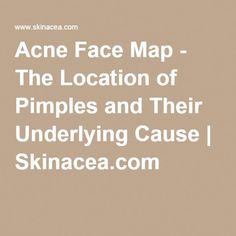 Body Acne Map, Under The Skin, Body Acne