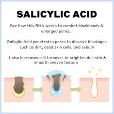 Salicylic acid Salicylic Acid Benefits, Serious Skin Care, Acne Control, Taking Advantage