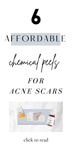 The best affordable chemical peels for acne scars. This guide will help you learn more about chemical peel benefits and the best chemical peels at home. Chemical Peel Before And After, Peels For Face, Acne Pictures, Chemical Face Peel, Best Chemical Peel, Before And After Acne, Skincare For Combination Skin, Mild Acne, Peeling Solution