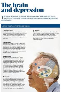 size: 12x8in Photographic Print: The brain and depression. : Healthy Brain Food, Dr Daniel Amen, 3 Day Juice Cleanse, Brain Healthy Foods, Healthy Life Hacks, Brain Connections, Psychology Fun Facts, Thigh Fat, Healthy Brain