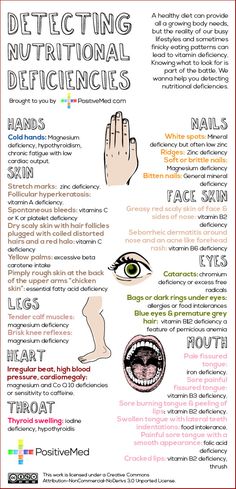 Nutritional deficiency Health Benefits Of Lime, Nutritional Deficiencies, Vitamins For Skin, Eye Health, Natural Medicine, Health Issues, Body Health