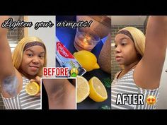 #beautyhacks #howto #skincaretipsHey Vibes Family! In todays video I’ll be showing you how to lighten your underarms armpit skin at home using Colgate toothp... Removing Dark Armpits, Lightening Underarms, Smelly Underarms, Black Armpits, How To Whiten Underarms, Dark Armpits, Underarm Odor, Armpit Fat, Dark Underarms