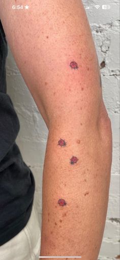 a person with red spots on their arm and leg, showing the area where it has been