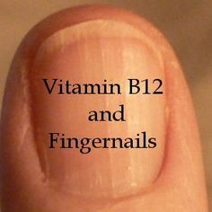 B12 and Fingernails | Health Boundaries Low Vitamin B12, Fingernail Health, Natural Healing Remedies, Nail Health