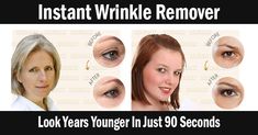 Within 2 minutes, wrinkle remover NeuBeauty reduces the appearance of under-eye bags, fine lines, wrinkles Organic Cream, Homemade Wrinkle Cream, Tumeric Face Mask, Under Eye Bags