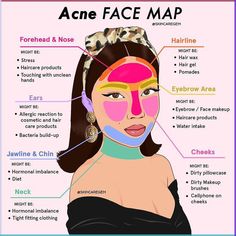 Acne Face Map, Face Map, Face Mapping Acne, Obličejové Masky, Haut Routine, Face Mapping, Skin Advice, Skin Care Routine Order, Basic Skin Care