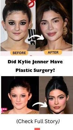 Extreme Plastic Surgery, Skincare Aesthetics, Doctor Medicine, Surgery Doctor, Hospital Health