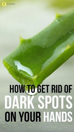 Just like the skin on our face, the skin on our hands too needs to be taken care of. Here are home remedies on how to get rid of dark spots on hands, have a look How To Get Rid Of Age Spots On Hands, Dark Spots On Hands How To Remove, Diy Dark Spot Remover, Dark Spots On Hands, Face Care Diy, Skin Cleanser Diy, Dark Spots On Legs, Oily Skin Care Tips, Brown Spots On Hands