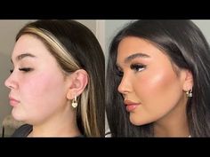 hi angels! i hope you enjoy this video. i’m so so happy with my results & im here for any questions you may have. love you!!!!WHERE I WENT: https://www.elite... Double Chin Fillers Before And After, Double Chin Injection, Contour Jawline Double Chin, Double Chin Removal Surgery, Chin And Jawline Fillers, Double Chin Lipo Before And After, Contouring Double Chin, Kybella Before And After Double Chin, Makeup For Double Chin