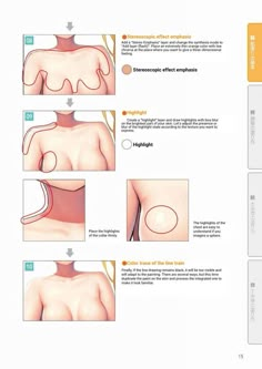 the instructions for how to use breast surgery