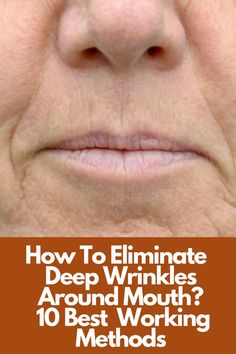 How To Eliminate  Deep Wrinkles Around Mouth? Mouth Wrinkles, Wrinkle Remedies, Anti Aging Skincare Routine, Wrinkle Free Skin, Anti Wrinkle Cream, Deep Wrinkles, Loose Skin, Wrinkle Cream