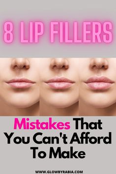 Different Types Of Lip Fillers, Where To Inject Lip Filler, Lip Filler Gone Wrong, Upper Lip Filler Before And After, Full Syringe Lip Filler Before And After, 1.5 Ml Lip Filler, Mini Lip Filler Before And After