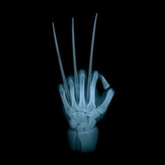 an x - ray image of a hand with claws