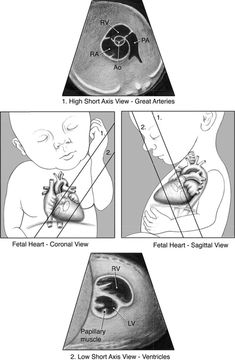 four stages of the heart and its functions are shown in black and white, including an image of a baby's stomach