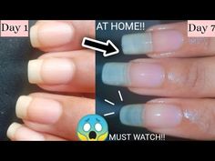 How To Do Accent Nails, How To Grow Longer Nails Fast, Fast Nail Growth Over Night, How To Grow Our Nails Faster, How To Clean Ur Nails, How To Grow Your Nails Longer, How To Keep Your Nails Clean, How To Get Long Nails Fast, How To Make Your Nails Grow Overnight