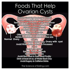 Foods that help ovarian cysts. Women Nutrition, Polycystic Ovaries, Be Healthy, Alternative Health, Health Issues, The Science, Organic Recipes, Health And Nutrition