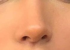 Upturned Nose, Rhinoplasty Nose Jobs, Straight Nose, Pretty Nose, Perfect Nose, Small Nose, Button Nose, Nose Shapes, Dream Vision Board