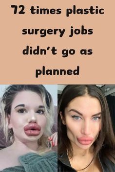 two women making funny faces with the caption'12 times plastic surgery jobs didn't go as planned '