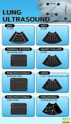 an info sheet showing the different types of umbrellas