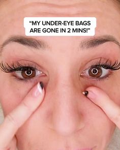 Eye Bag Removal Cream, Instant Eye Bag Removal, How To Reduce Eye Bags Naturally, How To Cover Up Eye Bags, How To Get Rid Of Under Eye Bags Fast, How To Reduce Under Eye Bags, How To Remove Eye Bags, How To Reduce Eye Bags, Under Eye Bags Remedies