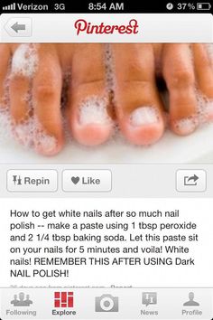 Diy Pedicure, Hand And Foot Care, Fungal Nail, Natural Hair Care Tips, Dark Nails, Nail Fungus, Nails At Home, Health And Beauty Tips