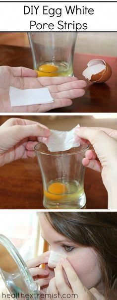 These DIY egg white pore strips pull out blackheads and whiteheads. The pore strips tighten pores and help prevent future breakouts! They're easy to make! Removing Blackheads, Blackhead Remover Diy, Blackhead Remedies, Pore Strips, Cold Sores Remedies, Remove Blackheads, Natural Sleep Remedies, Natural Cold Remedies