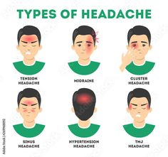 Types Of Headache, Tension Migraine, Nose Allergy, Tmj Headache, Acute Sinusitis, Sinus Cavities