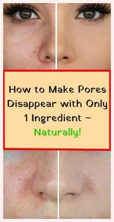 Face Pores, Skin Care Wrinkles, Large Pores, Skin Pores, Natural Face, Maquillaje Natural, Clean Face, Face Skin Care, Health And Beauty Tips