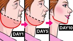 a woman's face is shown with arrows pointing to the different stages of her nose