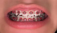 Red Braces, Cute Braces, Braces Colors, Dental Braces, Braces, Vision Board, Collage, Red, Anime