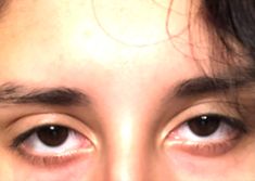 a close up of a person's eyes with hair on the top of their head