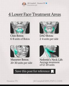 Jill Campbell - Houston Nurse Practitioner | ▪️Have you tried Botox in the lower face? ▪️Here is the low down… ▪️Lower face botox 101: top 4 areas 1.) Botox in your chin, 6-8… | Instagram Botox Face Lift, Medspa Office, Botox Aesthetic, Dao Botox Injection, Botox Injection Sites Amounts, Botox Eleven Lines, Botox Forehead Injection Sites, Armonizacion Facial, How Many Units Of Botox Do I Need