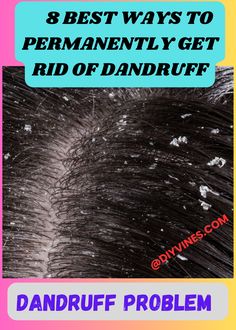 Tired of dealing with dandruff? Try these 8 proven treatments for long-term dandruff relief! From natural remedies to hair care tips, say goodbye to flakes for good.

 #DandruffCure #HairCareTips #AntiDandruff #NaturalRemedies #HealthyScalp #FlakeFree
#DandruffTreatment #HealthyHair #ScalpCare #NaturalCures #FlakeFreeHair #AntiDandruffRemedies #DandruffSolution #PermanentDandruffCure #HairCareRoutine #NaturalScalpCare #FlakeFreeScalp #DandruffRemedies Dandruff Solutions, Rid Of Dandruff, Dandruff Remedy, Getting Rid Of Dandruff, Diy Hair Care, Skin Disorders, Anti Dandruff, Healthy Scalp