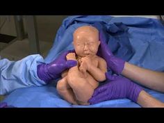 How to Deliver a Baby in Breech Presentation | Merck Manual Professional Version - YouTube Fetal Heart Rate, Delivering A Baby, Obstetrics And Gynaecology, Reference Book, Medical Information, Medical Center, Head And Neck