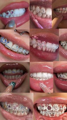 Tooth Gem Placement, Teeth Gems, Pretty Teeth, Dental Jewelry, Grillz Teeth, Cute Braces, Diamond Teeth, Dope Jewelry Accessories, Braces Colors