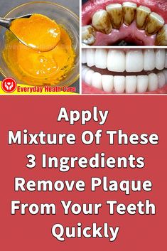 Baking Soda Teeth Whitening, Teeth Whitening Homemade, Teeth Whitening Remedies, Heath Care, Dental Plaque, Whiten Your Teeth