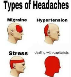 different types of headaches for people with red hair and beards on their heads