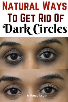 Dark Rings Under Eyes, Darkcircles Skincare, Dark Spots Under Eyes, Hooded Eyelids