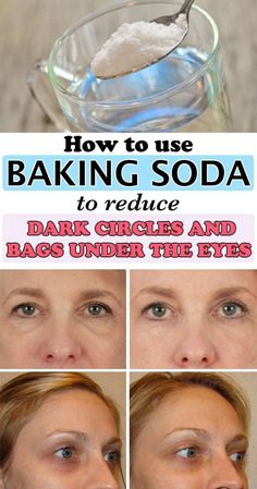 Baking Soda Under Eyes, Natural Hacks, Baking Soda Shampoo Recipe, Baggy Eyes, Face Treatments, Remove Eye Bags, Brown Spots On Face, Beauty Regime, Baking Soda Uses