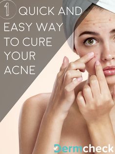 Struggling with acne? Tired of trying at home remedies that aren't working? There's now an answer: DermCheck App. See a dermatologist right through your phone and receive a treatment plan and prescriptions, all without leaving your home! Get Clear Skin, Prevention Month, App Landing Page, Tired Of Trying, Acne Solutions, Cystic Acne, Skin Remedies